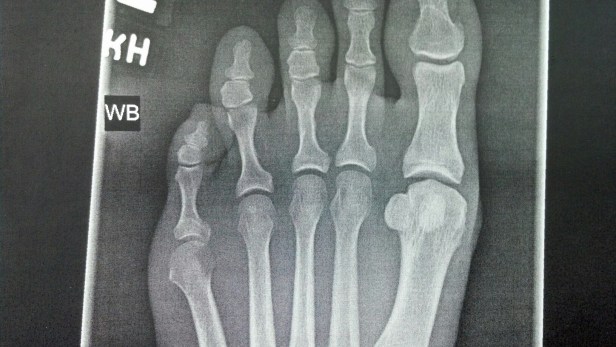 467898_10201281779352252_529042904_o